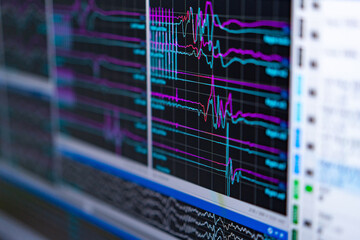 Visualizing brain activity data. Colorful waveforms represent brain activity during an EEG...