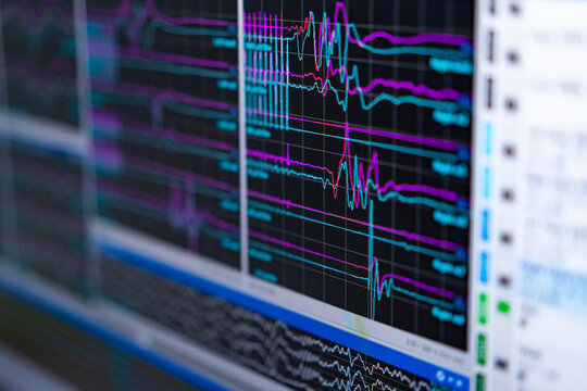 Visualizing brain activity data. Colorful waveforms represent brain activity during an EEG recording in a clinical setting.