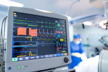 Heart monitor shows vital signs. A heart rate monitor displays vital signs during a surgical...