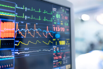 Monitoring vital signs. A close-up view of a medical monitor displaying vital signs, including...