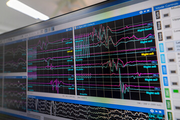 Lab brain activity monitoring. Complex brain wave patterns captured on digital screens show various neurological signals in a research laboratory.