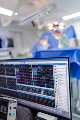Monitoring ongoing surgery. Detailed vital signs displayed on a monitor while a surgical procedure occurs in a hospital operating room.