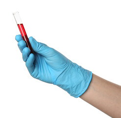 Doctor in medical glove holding test tube with blood sample on white background, closeup