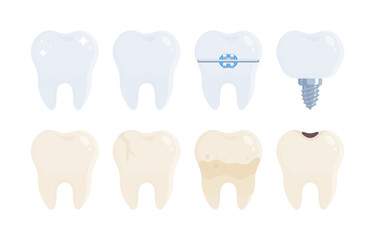 Set of healthy and damaged teeth. Tooth with braces, tartar, cavity and implant. Dentistry, dental care, orthodontics, oral health concept. Flat vector illustration isolated on white background