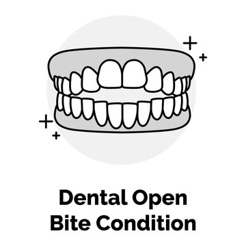 Dental Open Bite Condition Icon. Teeth Gap Symbol. Illustration for Malocclusion Treatment Concept.