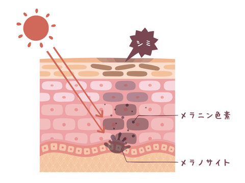 肌の断面図で見るシミが出来る図解イラスト