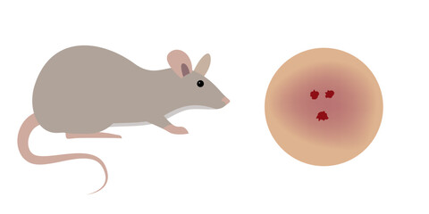 Rat Biting Human Skin Causing Bleeding Wound and Infection