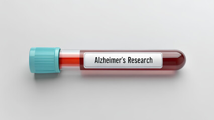 Fototapeta premium anti-amyloid Alzheimer's Testing Alzheimer research is vital for anti amyloid testing to improve understanding and treatment options