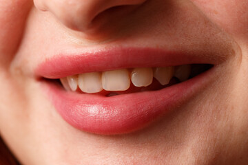 A woman's mouth is open, showing her teeth