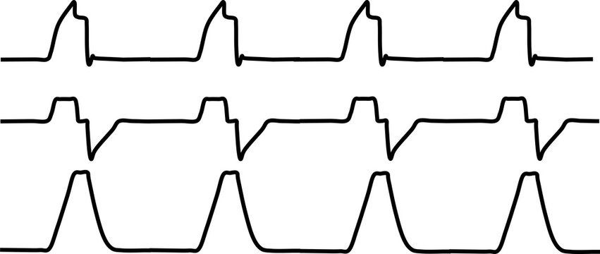 人工呼吸器のグラフィック波形の素材イラスト