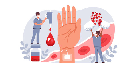 Treatment of iron deficiency anemia. Drops, tablets, medications to increase the level of iron in the human body. Health and medicine. Vector flat illustration.