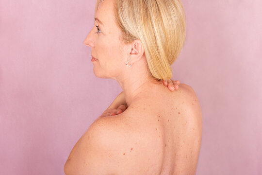 Woman Promotes Skin and Breast Cancer Awareness with Care