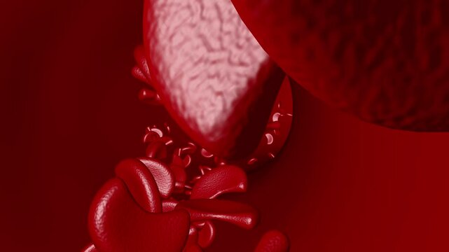 Sickle cell disease move inside blood vessel artery vein 4k