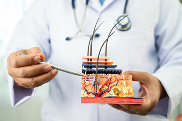 Hair transplant, Asian dermatologist doctor holding skin structure anatomy model for treatment in hospital.
