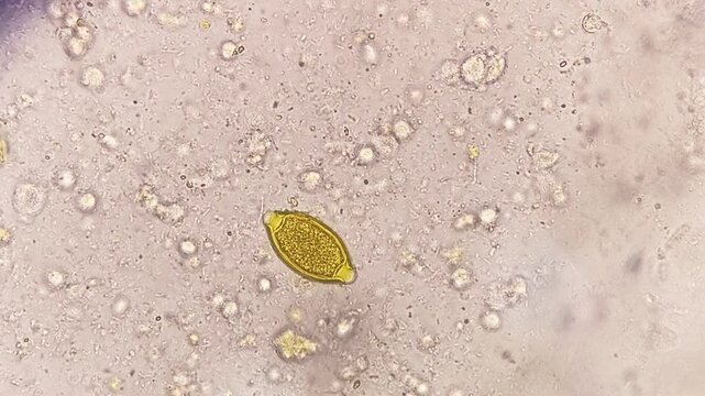 Photomicrographic footage showing Eggs of Trichuris trichiura (whipworm) in stool.
