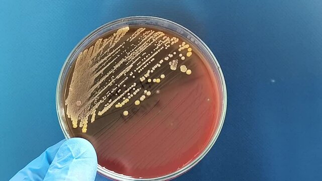 Footage, petri dish with colony of Gram-positive, to Gram-variable, nonmotile, Coccus, beta hemolysis, saprotrophic bacterium that belongs to the family Staphylococcus growth on blood agar.