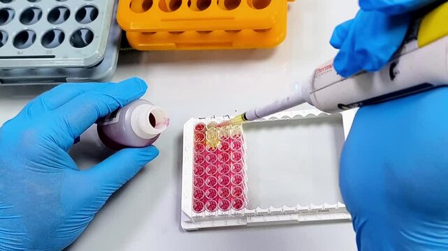 Scientist working with microplate in the medical laboratory. Researcher performing ELISA for immunological analysis in Laboratory