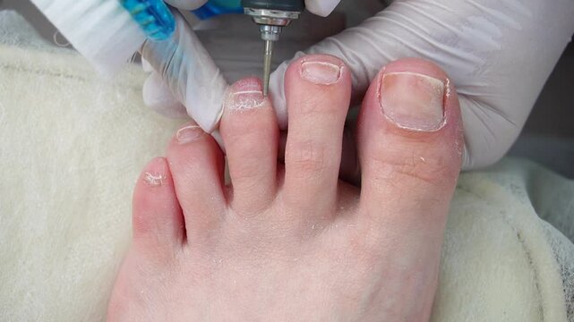 Professional hardware pedicurist, podiatrist cleaning nails using a nail miller