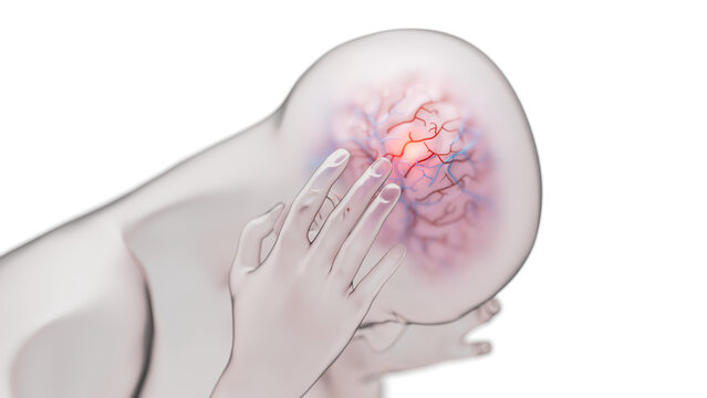 Brain condition, conceptual illustration