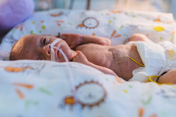 Premature baby with nasal tube looking up in incubator