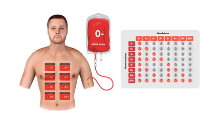 A 3D medical illustration of an O negative blood donor showing transfusion, recipient compatibility, and a detailed blood type matching chart, graphic