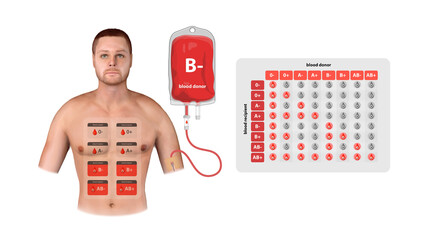 A 3D infographic of B Negative blood donation, demonstrating transfusion process, donor-recipient compatibility, and medical applications