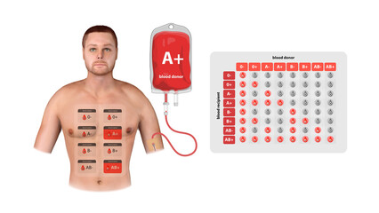 A 3D medical infographic of A Positive blood donation, illustrating transfusion process, compatibility, and recipient eligibility