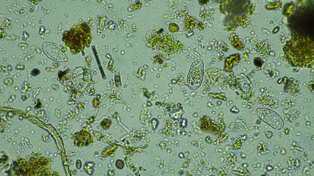 human parasite. gut intestinal infection disease. microorganism infection in hospital