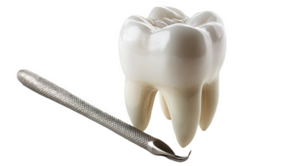 Dental Scaling Procedure Illustration