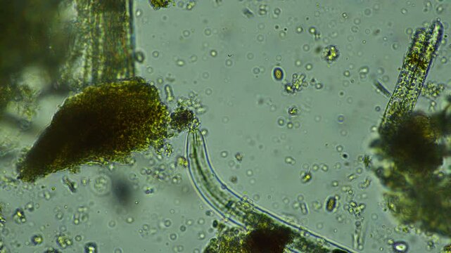 human parasite. gut intestinal infection disease. microorganism infection in hospital