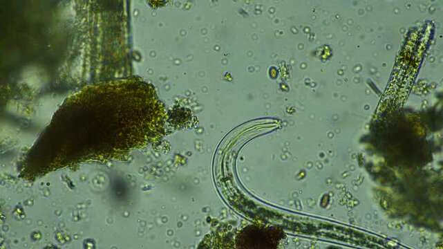 human parasite. gut intestinal infection disease. microorganism infection in hospital