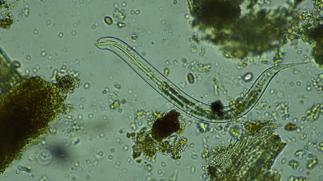 human parasite. gut intestinal infection disease. microorganism infection in hospital