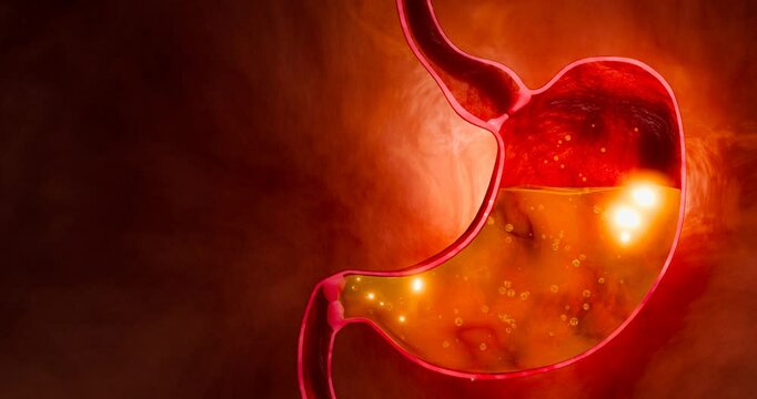 Symptoms of acid reflux or excess acid in the stomach. Gastric juice and intestinal model within the abdominal cavity. Pressure or air causes stomach pain. 3D Rendering.