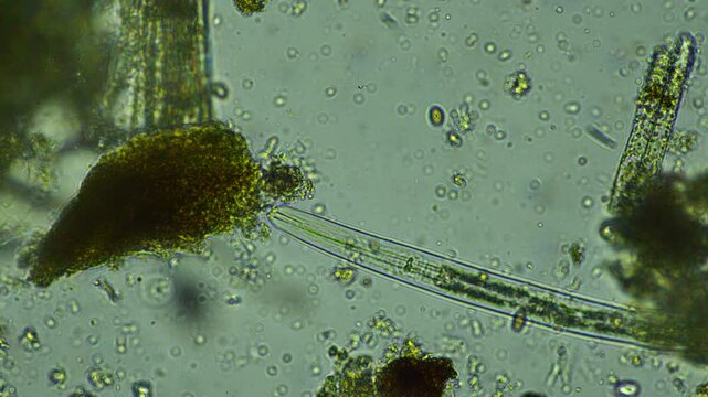 human parasite. gut intestinal infection disease. microorganism infection in hospital