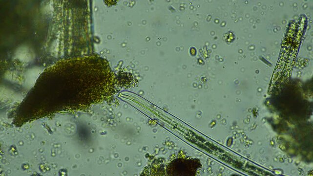 human parasite. gut intestinal infection disease. microorganism infection in hospital
