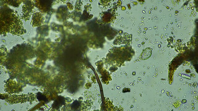 human parasite. gut intestinal infection disease. microorganism infection in hospital