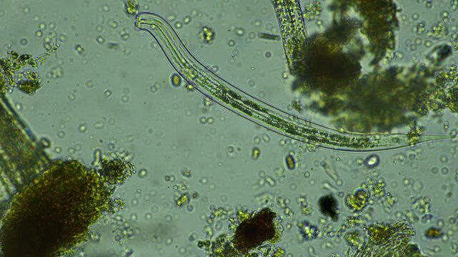 human parasite. gut intestinal infection disease. microorganism infection in hospital