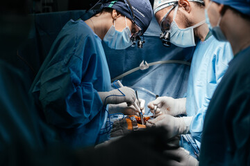 A team of experienced surgeons performing a complex operation with full concentration in well-lit operating room. Professional Medical Doctors Performing Surgery. The latest technology in cardiology 