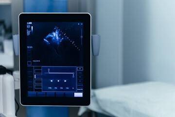Close-up Ultrasound image on the monitor in the operating room during surgery. Ultrasound scan...