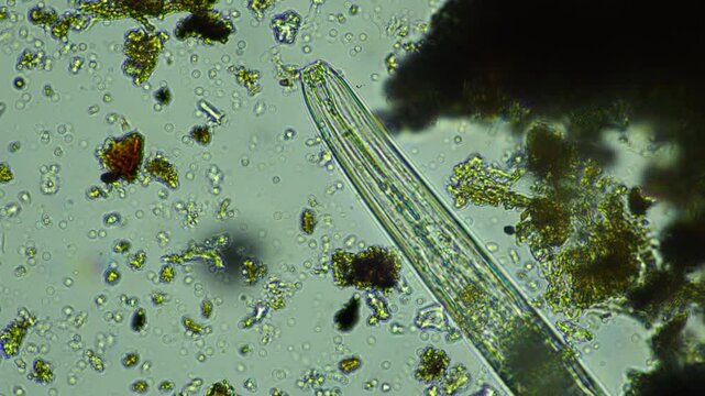 human parasite. gut intestinal infection disease. microorganism infection in hospital