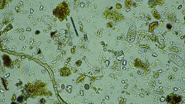 human parasite. gut intestinal infection disease. microorganism infection in hospital