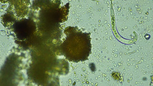 human parasite. gut intestinal infection disease. microorganism infection in hospital