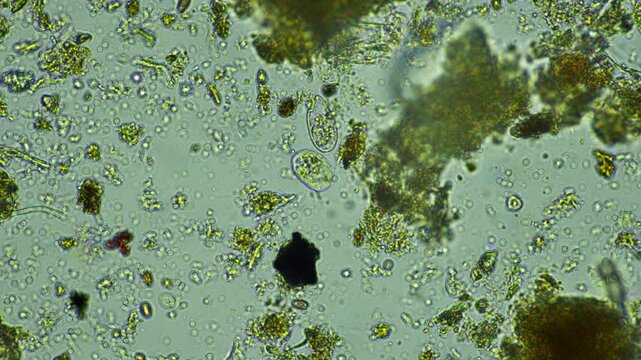 human parasite. gut intestinal infection disease. microorganism infection in hospital