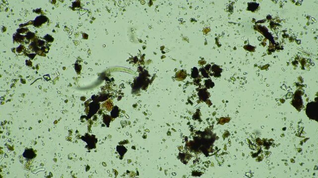 human parasite. gut intestinal infection disease. microorganism infection in hospital