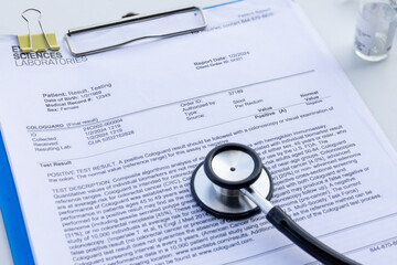 A well-organized medical setup featuring a clipboard containing a colon cancer test result, with a stethoscope resting beside it.