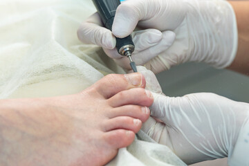 Professional hardware pedicurist, podiatrist cleaning nails using a nail miller