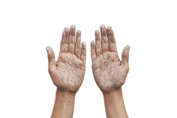 two hands with dirty skin on them cutout and isolated on transparent background 