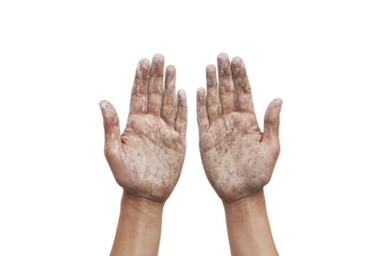 two hands with dirty skin on them cutout and isolated on transparent background 