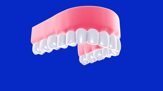 3D animation of a dental cap in a transparent glass graphic style. Showing the action of placing it on a realistic-style gum and denture. Viewed from below on a blue background.