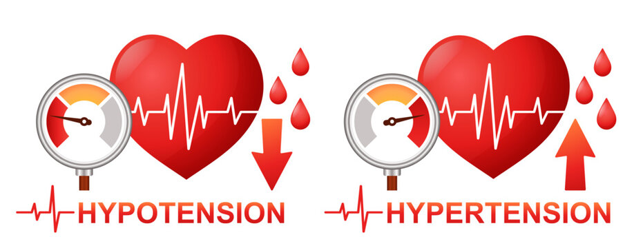 Blood arterial pressure measuring, heart hypertension, cardiac hypotension cardiology cardiovascular disease medical treatment. High, low heartbeat pulse, tonometer. Cardio attack. Health care. Vector